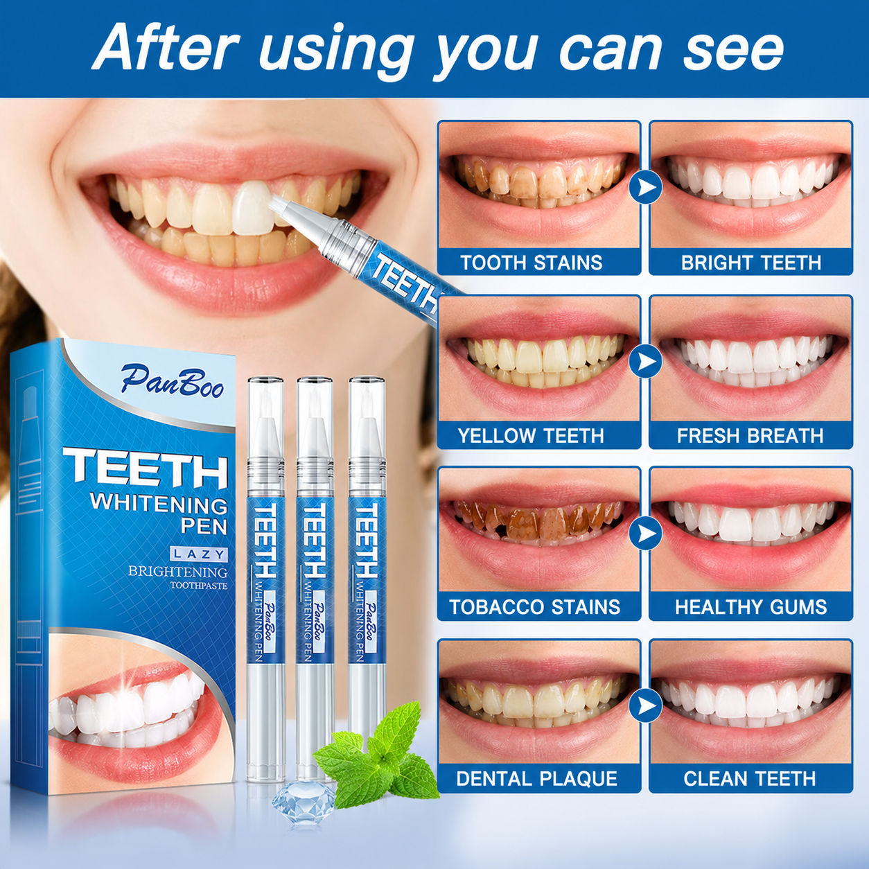 PanBoo Teeth Whitening Pen – Remove Stains & Brighten Your Smile